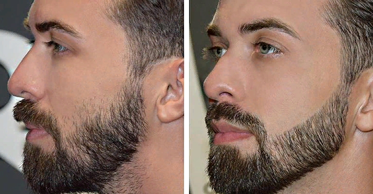 Как отрастить бороду правильно и быстро по шагам (30+ фото): этапы роста с нуля, мужчине и подростку, советы как ускорить рост щетины46